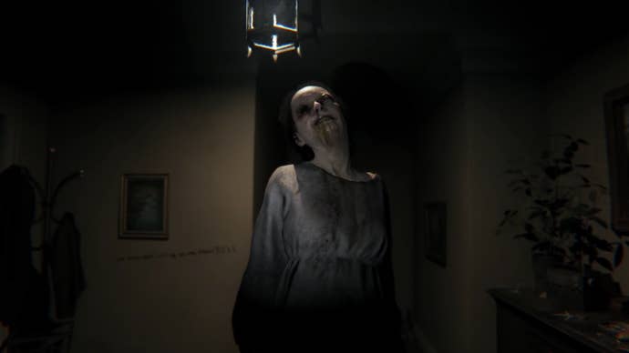 A closeup of the disfigured woman in PT.